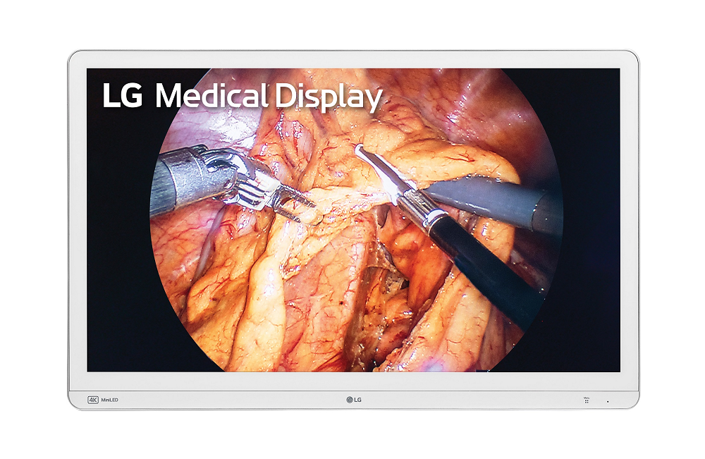 LG’s New 32HR734S 4K Surgical Monitor With Mini LED Technology Delivers Outstanding Image Quality